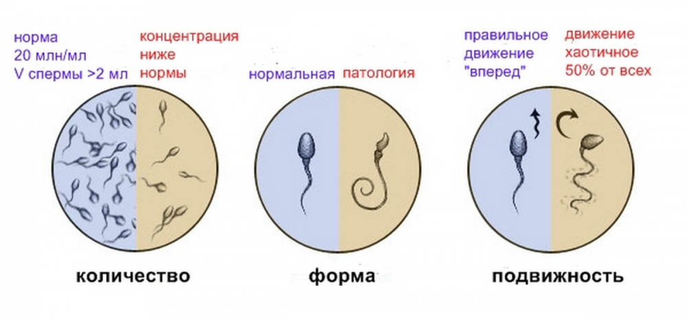 Анализ Спермы Эротика