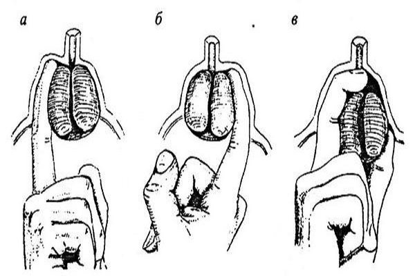 методика массажа пальцем