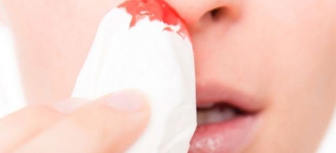 Причины выделения крови из носа при сморкании