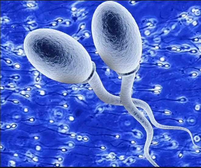 склеенные сперматозоиды