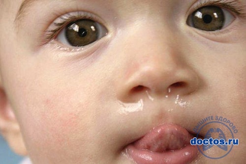 Сопли при прорезывании зубов у ребенка