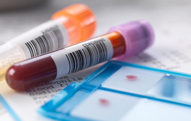 Забор и подготовка крови к анализу на гормоны