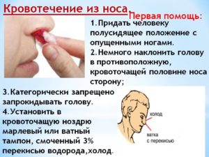 Причины появления крови в носу у детей