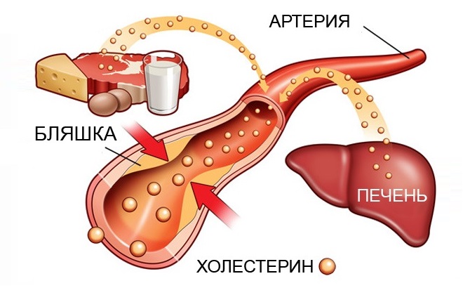 Схема попадания холестерина в организм человека