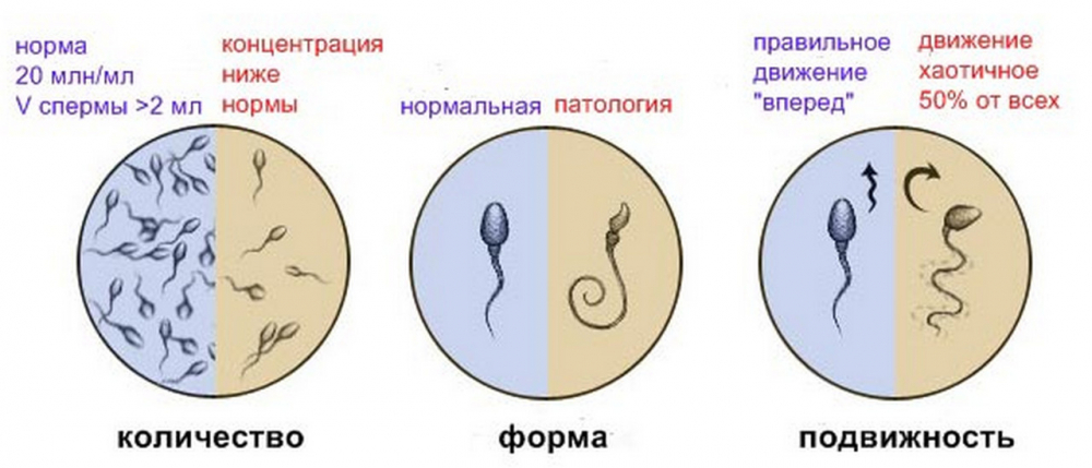 Морфология сперматозоидов: анализ спермы, норма спермограммы по ...