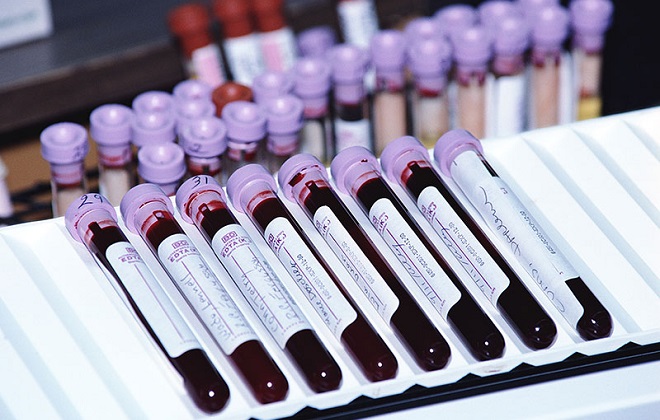 Подготовка собранной крови для анализа