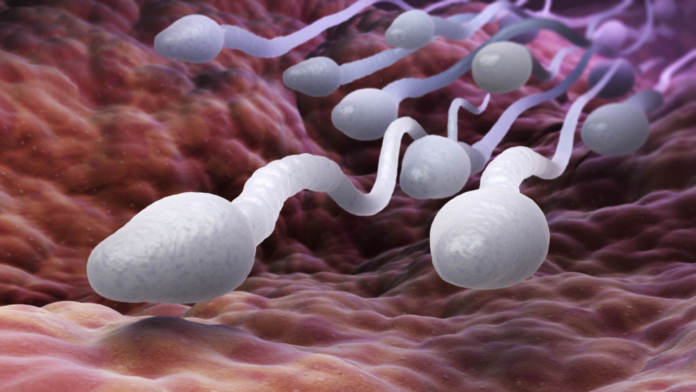 Расшифровка анализа спермы: норма, отклонение от нормы и возможные ...