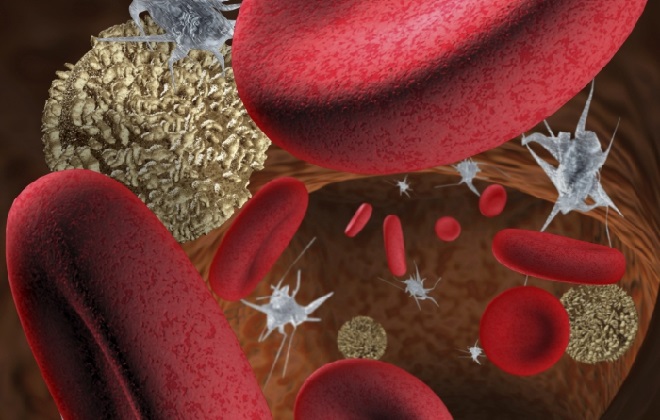 Высокий показатель содержания тромбоцитов в анализе крови