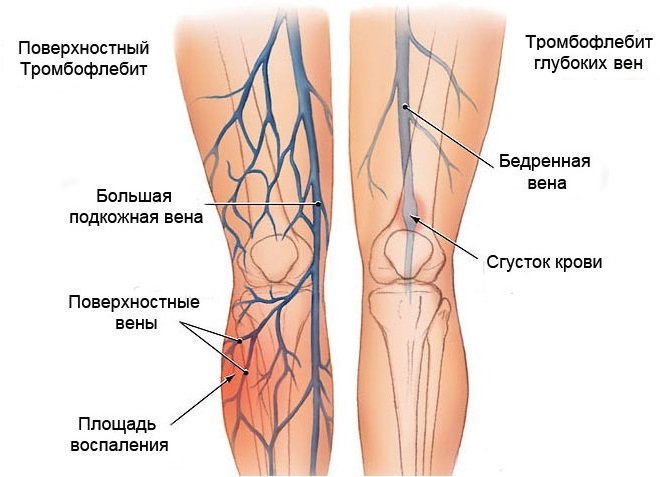 Поверхностные и внутренние вены ног