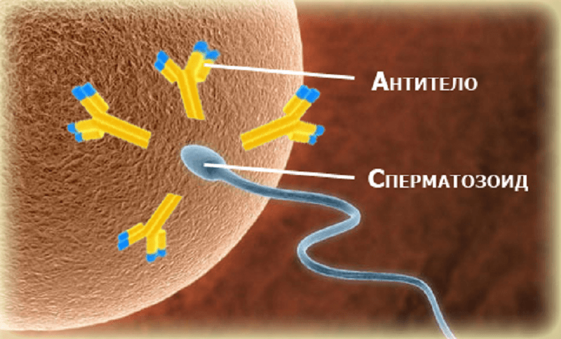 Антиспермальные антитела (АСАТ) - статьи | ЭКО-блог