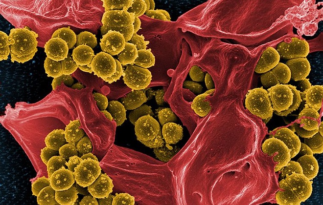 Проявление бактерий стафилококков в крови