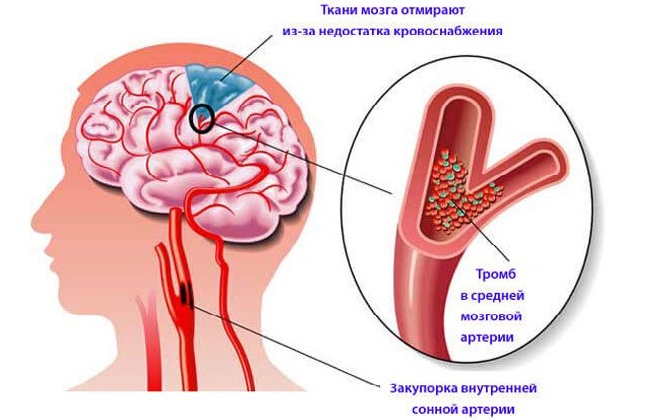 Изображение мозга человека в разрезе