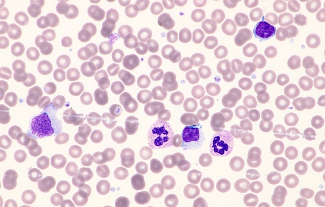 Общие лейкоциты крови