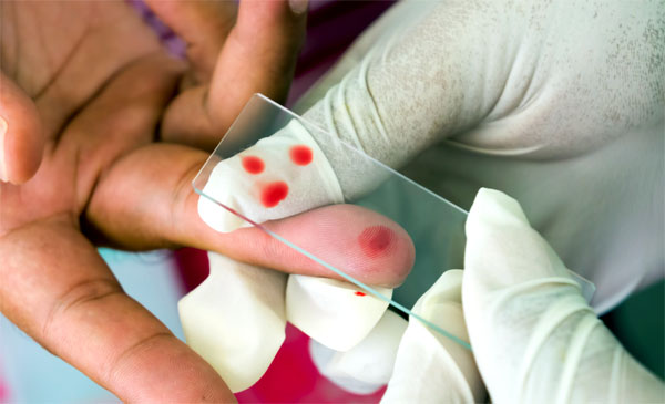Общий анализ крови при поносе